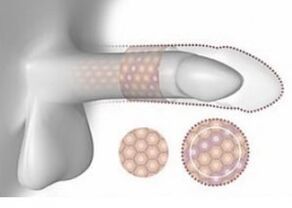 Padidėjęs varpa tūrio