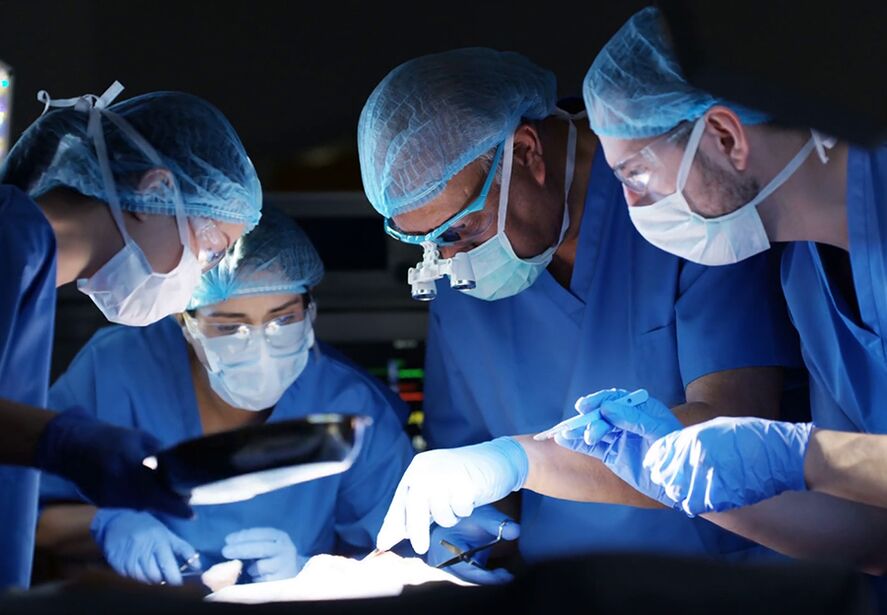 varpos didinimo operacija