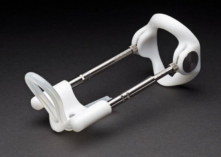 ilgintuvas po varpos didinimo operacijos